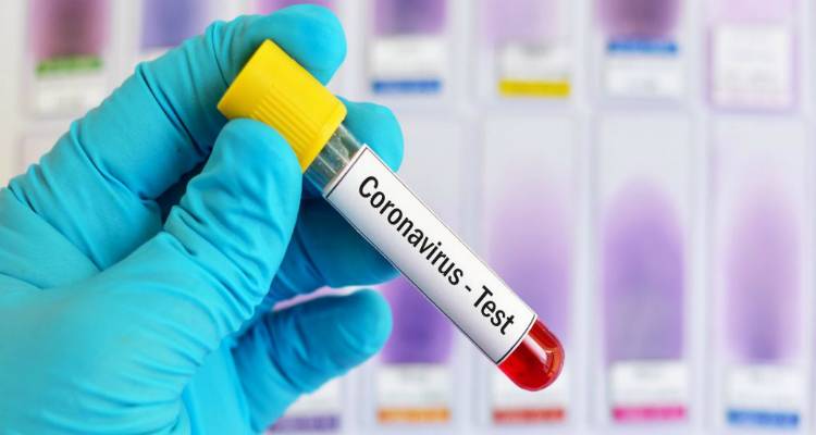 COVID-19: &Omicron;&lambda;&omicron;&kappa;&lambda;&eta;&rho;&omega;&mu;έ&nu;&omicron; &sigma;&chi;έ&delta;&iota;&omicron; &gamma;&iota;&alpha; &tau;&eta;&nu; &alpha;ύ&xi;&eta;&sigma;&eta; &tau;&omega;&nu; &epsilon;&rho;&gamma;&alpha;&sigma;&tau;&eta;&rho;&iota;&alpha;&kappa;ώ&nu; &epsilon;&xi;&epsilon;&tau;ά&sigma;&epsilon;&omega;&nu;