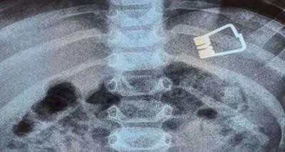 &Lambda;ή&mu;&nu;&omicron;&sigmaf; &ndash; &Alpha;&gamma;&omicron;&rho;ά&kappa;&iota; &delta;ύ&omicron; &epsilon;&tau;ώ&nu; &kappa;&alpha;&tau;ά&pi;&iota;&epsilon; έ&lambda;&alpha;&sigma;&mu;&alpha; &alpha;&pi;ό &mu;&alpha;&nu;&tau;&alpha;&lambda;ά&kappa;&iota;