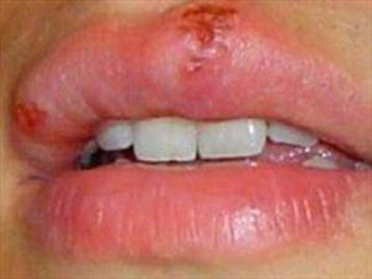 &Epsilon;&pi;&iota;&chi;&epsilon;ί&lambda;&iota;&omicron;&sigmaf; έ&rho;&pi;&eta;&sigmaf; &kappa;&alpha;&iota; &epsilon;&rho;&pi;&eta;&tau;&omicron;&epsilon;&iota;&delta;ή&sigmaf; &sigma;&tau;&omicron;&mu;&alpha;&tau;ί&tau;&iota;&delta;&alpha;