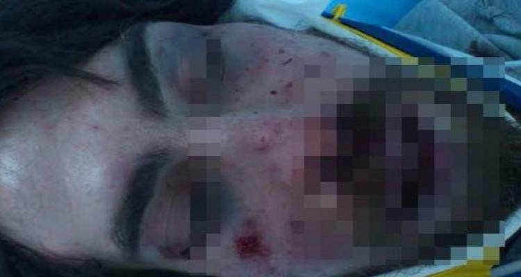 &Sigma;&upsilon;&nu;&epsilon;&lambda;ή&phi;&theta;&eta; &chi;&rho;&upsilon;&sigma;&alpha;&upsilon;&gamma;ί&tau;&eta;&sigmaf; &gamma;&iota;&alpha; &tau;&omicron;&nu; ά&gamma;&rho;&iota;&omicron; &xi;&upsilon;&lambda;&omicron;&delta;&alpha;&rho;&mu;ό &tau;&omicron;&upsilon; &phi;&omicron;&iota;&tau;&eta;&tau;ή