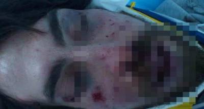 &Sigma;&upsilon;&nu;&epsilon;&lambda;ή&phi;&theta;&eta; &chi;&rho;&upsilon;&sigma;&alpha;&upsilon;&gamma;ί&tau;&eta;&sigmaf; &gamma;&iota;&alpha; &tau;&omicron;&nu; ά&gamma;&rho;&iota;&omicron; &xi;&upsilon;&lambda;&omicron;&delta;&alpha;&rho;&mu;ό &tau;&omicron;&upsilon; &phi;&omicron;&iota;&tau;&eta;&tau;ή