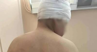 &Theta;&epsilon;&sigma;&sigma;&alpha;&lambda;&omicron;&nu;ί&kappa;&eta;: &Sigma;&omicron;&kappa;ά&rho;&epsilon;&iota; &omicron; &pi;&alpha;&tau;έ&rho;&alpha;&sigmaf; &tau;&omicron;&upsilon; 13&chi;&rho;&omicron;&nu;&omicron;&upsilon; &pi;&omicron;&upsilon; &xi;&upsilon;&lambda;&omicron;&kappa;&omicron;&pi;ή&theta;&eta;&kappa;&epsilon; | &laquo;&Tau;&omicron;&nu; &chi;&tau;&upsilon;&pi;&omicron;ύ&sigma;&alpha;&nu; &mu;&epsilon; &sigma;ί&delta;&epsilon;&rho;&alpha;, &lambda;&epsilon;ί&pi;&epsilon;&iota; &kappa;&omicron;&mu;&mu;ά&tau;&iota; &alpha;&pi;ό &tau;&omicron; &kappa;&epsilon;&phi;ά&lambda;&iota; &tau;&omicron;&upsilon;&raquo;