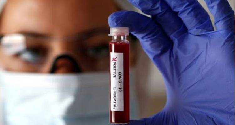 Λήμνος: 69 τα κρούσματα την προηγούμενη εβδομάδα