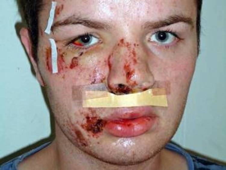 &Pi;&rho;ώ&tau;&alpha; &omicron;&iota; &mu;&epsilon;&tau;&alpha;&nu;ά&sigma;&tau;&epsilon;&sigmaf;, &mu;&epsilon;&tau;ά &omicron;&iota; &gamma;&kappa;έ&iota;, ύ&sigma;&tau;&epsilon;&rho;&alpha; &omicron;&iota; &alpha;&nu;ά&pi;&eta;&rho;&omicron;&iota;. Ό&pi;&omicron;&upsilon; &nu;&alpha; '&nu;&alpha;&iota; έ&rho;&chi;&epsilon;&tau;&alpha;&iota; &eta; &sigma;&epsilon;&iota;&rho;ά &sigma;&omicron;&upsilon;