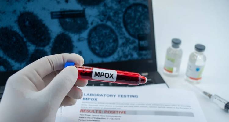 &Sigma;&upsilon;&nu;&alpha;&gamma;&epsilon;&rho;&mu;ό&sigmaf; &sigma;&tau;&omicron;&nu; &Epsilon;&Omicron;&Delta;&Upsilon;: &Epsilon;&pi;&iota;&beta;&epsilon;&beta;&alpha;&iota;ώ&theta;&eta;&kappa;&alpha;&nu; 18 &kappa;&rho;&omicron;ύ&sigma;&mu;&alpha;&tau;&alpha; mpox &sigma;&tau;&eta; &chi;ώ&rho;&alpha; &mu;&alpha;&sigmaf;