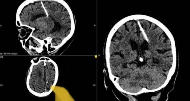 80&chi;&rho;&omicron;&nu;&eta; &zeta;&epsilon;&iota; &mu;&epsilon; &beta;&epsilon;&lambda;ό&nu;&alpha; &sigma;&tau;&omicron;&nu; &epsilon;&gamma;&kappa;έ&phi;&alpha;&lambda;&omicron; &alpha;&pi;ό &mu;&omega;&rho;ό | &laquo;&Omicron;&iota; &gamma;&omicron;&nu;&epsilon;ί&sigmaf; &tau;&eta;&sigmaf; &pi;&rho;&omicron;&sigma;&pi;ά&theta;&eta;&sigma;&alpha;&nu; &nu;&alpha; &tau;&eta; &sigma;&kappa;&omicron;&tau;ώ&sigma;&omicron;&upsilon;&nu; ό&tau;&alpha;&nu; ή&tau;&alpha;&nu; &eta;&mu;&epsilon;&rho;ώ&nu;&raquo;