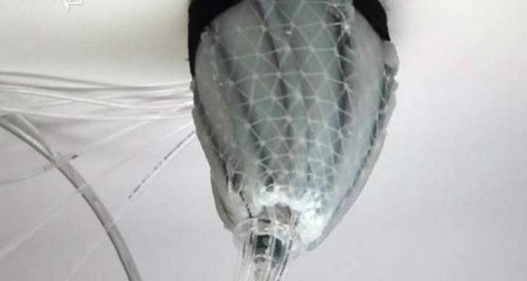 &Delta;&eta;&mu;&iota;&omicron;&upsilon;&rho;&gamma;ή&theta;&eta;&kappa;&epsilon; &tau;&omicron; &pi;&rho;ώ&tau;&omicron; &mu;&alpha;&lambda;&alpha;&kappa;ό &rho;&omicron;&mu;&pi;ό&tau; &pi;&omicron;&upsilon; &laquo;&alpha;&gamma;&kappa;&alpha;&lambda;&iota;ά&zeta;&epsilon;&iota;&raquo; &tau;&eta;&nu; &kappa;&alpha;&rho;&delta;&iota;ά &kappa;&alpha;&iota; &tau;&eta; &beta;&omicron;&eta;&theta;ά &nu;&alpha; &chi;&tau;&upsilon;&pi;ά(photo)