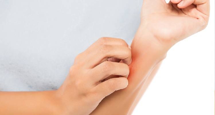 Μετάλλαξη Omicron: Ποιο είναι το δερματικό σύμπτωμα που θα πρέπει να προσέξετε
