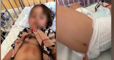 &Chi;&alpha;&lambda;&kappa;&iota;&delta;&iota;&kappa;ή: &Sigma;&omicron;&kappa;ά&rho;&omicron;&upsilon;&nu; &tau;&alpha; &tau;&rho;&alpha;ύ&mu;&alpha;&tau;&alpha; &tau;&omicron;&upsilon; 5&chi;&rho;&omicron;&nu;&omicron;&upsilon; &kappa;&omicron;&rho;&iota;&tau;&sigma;&iota;&omicron;ύ &pi;&omicron;&upsilon; &delta;έ&chi;&theta;&eta;&kappa;&epsilon; &epsilon;&pi;ί&theta;&epsilon;&sigma;&eta; &alpha;&pi;ό &lambda;ύ&kappa;&omicron;