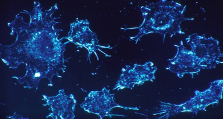 Θεραπεία-ορόσημο για τον καρκίνο του αίματος ξεκινά στο NHS: «Δούρειος Ίππος» κατά του μυελώματος