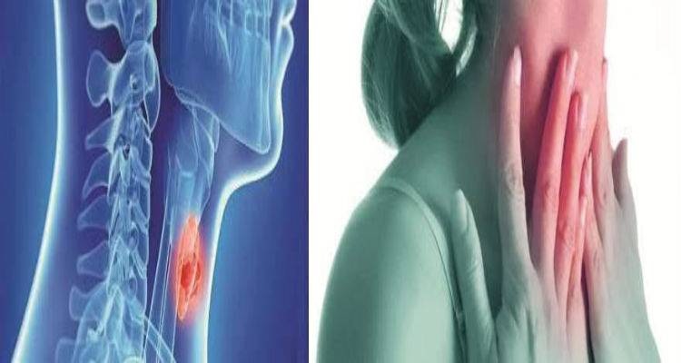 Ύποπτοι για καρκίνο οι όζοι του θυρεοειδούς που αυξάνονται παρά τη θεραπεία