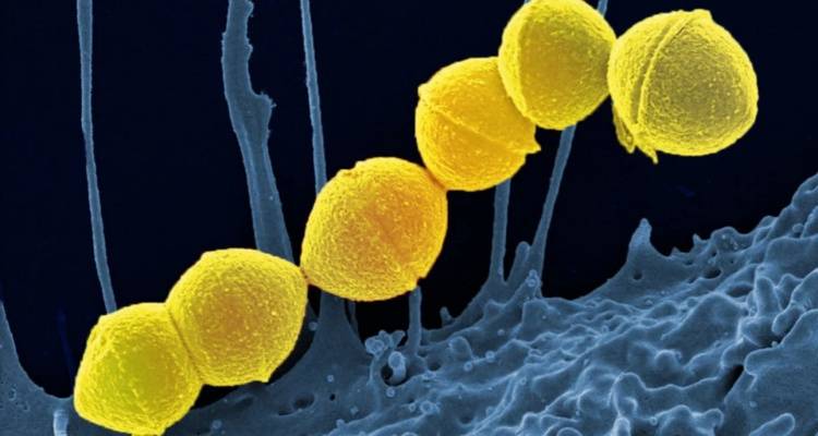 &Sigma;&upsilon;&nu;&alpha;&gamma;&epsilon;&rho;&mu;ό&sigmaf; &sigma;&tau;&eta;&nu; &Iota;&alpha;&pi;&omega;&nu;ί&alpha;: &Epsilon;&xi;&alpha;&pi;&lambda;ώ&nu;&epsilon;&tau;&alpha;&iota; &mu;&upsilon;&sigma;&tau;&eta;&rho;&iota;ώ&delta;&eta;&sigmaf; &lambda;&omicron;ί&mu;&omega;&xi;&eta; &sigma;&tau;&rho;&epsilon;&pi;&tau;ό&kappa;&omicron;&kappa;&kappa;&omicron;&upsilon; &pi;&omicron;&upsilon; &tau;&rho;ώ&epsilon;&iota; &tau;&eta; &sigma;ά&rho;&kappa;&alpha;