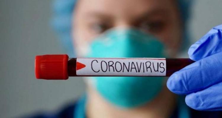Κορωνοϊός: 33 νέα κρούσματα, 2.114 συνολικά | Στους 98 οι νεκροί
